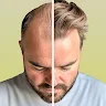 HairCode·Hair Loss Scanner AI 's icon